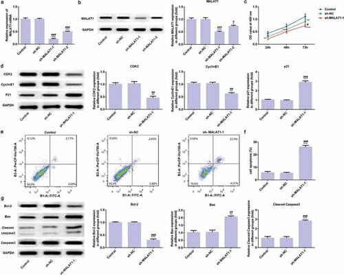 Figure 2. LncRNA MALAT1 interference inhibits proliferation and promotes apoptosis of myeloma cells. (A) The transfection effect was assessed by RT-qPCR. ***P < 0.001 vs. control group. ###P < 0.001 vs. sh-NC group. (B) The transfection effect was assessed by western blot. *P < 0.05 and ***P < 0.001 vs. control group. #P < 0.05 and ###P < 0.001 vs. sh-NC group. (C) The effect of LncRNA MALAT1 interference on cell proliferation was determined by CCK-8 assay. **P < 0.01 and ***P < 0.001 vs. control group. #P < 0.05 vs. sh-NC group. (D) The proliferation related proteins (CDK2, cyclinE1, and P21) were detected by Western blot. **P < 0.01 and ***P < 0.001 vs. control group. ##P < 0.01 and ###P < 0.001 vs. sh-NC group. (E/F) The cell apoptosis rate was determined by flow cytometry analysis. ***P < 0.001 vs. control group. ###P < 0.001 vs. sh-NC group. (G) The apoptosis related proteins (Bcl-2, Bax, and cleaved caspase3) were detected by Western blot. **P < 0.01 and ***P < 0.001 vs. control group. ##P < 0.01 and ###P < 0.001 vs. sh-NC group