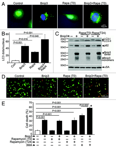 Figure 1. Rapamycin treatment does not protect against BNIP3-induced cell death. (A) Representative epifluorescence images (630× magnification) demonstrating cellular localization of GFP-LC3 in NRCMs adenovirally transduced with BNIP3 or LacZ (as control) for 48 h, and treated with rapamycin (100 nmol/L) at T (time) = 0 (simultaneously at transduction). Nuclei are blue (DAPI). (B) Quantitation of punctate GFP-LC3 dots in cells from (A) (n = 25–40 nuclei/group). p values are by post-hoc test. (C) Immunoblot demonstrating LC3, p62 and BNIP3 (FLAG) expression in NRCMs adenovirally transduced with BNIP3 or LacZ (Con) for 48 h, and treated with rapamycin (100 nmol/L) at T (time) = 0 or 24 h after transduction. Expression of α-sarcomeric actin (αSA) was assessed as loading control. (D) Representative images (200× magnification) demonstrating live (green) and dead (red) cells treated as in (A). (E) Cell death in NRCMs adenovirally transduced with BNIP3 or LacZ (as control) for 48 h, and treated with rapamycin (100 nmol/L) at T(time) = 0 or 24 h after transduction; or 3 methyl-adenine (7 mmol/L) at t = 24 h. n = 8/group. *p < 0.001 vs Bnip3-expressing cells. All p values are by post-hoc test.