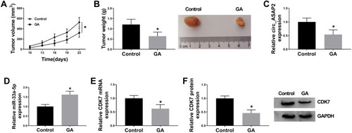Figure 8 GA exposure decreases GC growth in vivo. (A) GA exposure inhibited tumor volume in vivo. (B) The tumor weight was decreased by GA treatment in vivo. (C) QRT-PCR detected circ_ASAP2 expression in GA-mediated GC tissues in vivo. (D) QRT-PCR determined miR-33a-5p expression in GA-mediated GC tissues in vivo. (E and F) The mRNA and protein levels of CDK7 were determined by qRT-PCR and Western blot, respectively, in GC tissues treated GA. *P < 0.05.