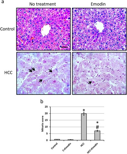 Figure 5. Effect of oral administration of emodin (40 mg/kg, P.O) on liver sections stained with Haematoxylin/eosin. (a) Representatives of microscopic pictures of liver sections stained with haematoxylin/eosin showing normally arranged hepatic cords around central veins. Liver section from HCC group show well-differentiated HCC. Cells of HCC are polygonal with distinct cell membranes, an eosinophilic granular cytoplasm and prominent nucleoli (black arrows). Sections from HCC group orally treated with 40 mg/kg emodin show improvement of the structure of hepatocytes. Scale bare represented 50 µm. (b) Mitotic score calculated using high field powers in 10 different areas of each rat. The results of the mitotic figure are presented as the mean ± SE. * Significant difference as compared with the control groups at p < 0.05. # Significant difference as compared with the HCC group at p < 0.05. C, control; HCC, hepatocellular carcinoma.