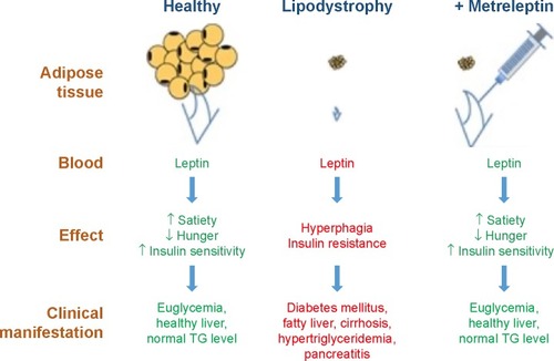 Figure 1 Clinical action of metreleptin treatment in adipose-deficient lipodystrophic patients.
