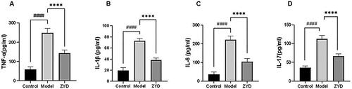 Figure 9. (A–D) the level of serum inflammatory cytokines TNF-α, IL-1β, IL-6, and IL-17 in mice. ####p < .0001 compared with the control group. ****p < .0001 compared with the model group.