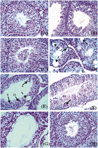 Figure 1. PAS–haematoxylin stained sections of mouse testis. (A) Control to show normal appearance of the seminiferous tubules. (B) After Citrus limon (C. limon) treatment, 500 mg/kg body weight/day for 35 days and sacrificed 24 hours after the last treatment to show loosening of germinal epithelium in the seminiferous tubules. (C) After the same treatment as shown in (B) to show exfoliation of germ cells in the lumen of a tubule. (D) After the same treatment as shown in (B). Note marginal condensation of chromatin in round spermatids (arrow) in a seminiferous tubule and appearance of intraepithelial vacuoles (broken arrows) in the tubules. (E) After C. limon treatment, 1000 mg/kg body weight/day for 35 days and sacrificed 24 hours after the last treatment. Note mixing of spermatids of different stages of spermatogenesis in a seminiferous tubule; steps 8, 9, and 10 spermatids are seen in the same tubule and an intraepithelial vacuole (broken arrow) is also seen in the tubule. (F) After the same treatment as shown in (E) to show occurrence of giant cells (arrow) containing 9 nuclei of round spermatids in the epithelium of a seminiferous tubule. (G) After the same treatment as shown in (E) to show severe degenerative changes in the seminiferous tubules. The tubule in the centre is lined by Sertoli cells and a few germ cells. (H) After C. limon treatment, 1,000 mg/kg body weight/day for 35 days and sacrificed 56 days after treatment withdrawal to show normal appearance of the seminiferous tubules (cf. part A). Scale bar = 50 μm.