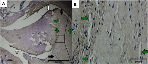 Figure 9 (A) BSP-positive staining is situated mostly in and close to the synovial membrane (white arrows) and in the superficial cartilage of the tibia (T) and the meniscus (M). Superior and inferior capsular regions are pointed out by black arrows. In the enlarged view of the capsule behind the meniscus, (B) BSP-stained areas can be found close to the meniscal border and around vessels (green arrows).