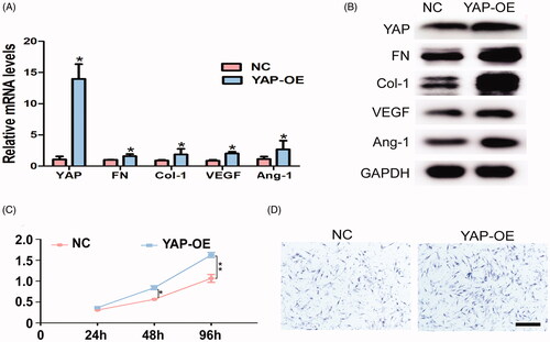 Figure 5. YAP promotes proliferation, migration, and differentiation in GMSCs. (A) qRT-PCR analysis for the expression levels of YAP, Col-1, FN, VEGF, and ANG-1 in GMSCs treated with YAP control and overexpression plasmids. (B) Western blot assay for the expression of Col-1, FN, VEGF, and ANG-1 proteins for GMSCs treated with YAP control and overexpression plasmids. (C) CCK8 assay for GMSCs treated with YAP control and overexpression plasmids at 2, 44, 872 h. (D) Transwell assay for GMSCs treated with YAP control and overexpression plasmids. Scale bars: 100 μm. *p < .05; **p < .01.