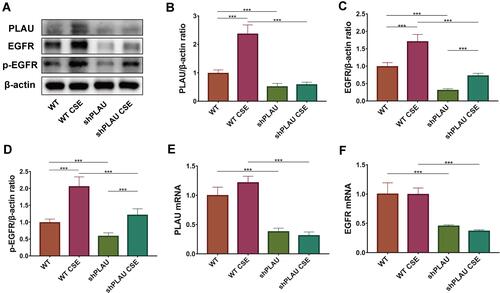 Figure 8 PLAU knockdown reduced EGFR signaling in vitro. (A) Levels of PLAU, EGFR, p-EGFR, and β-actin proteins in human bronchial epithelial (HBE) cells were measured by Western blotting analysis. Quantitative analysis of (B) PLAU, (C) EGFR, and (D) p-EGFR. mRNA levels of (E) PLAU, (F) EGFR. Error bars represent SD. *P < 0.05; **P < 0.01; ***P < 0.001. shRNA vectors targeting PLAU.