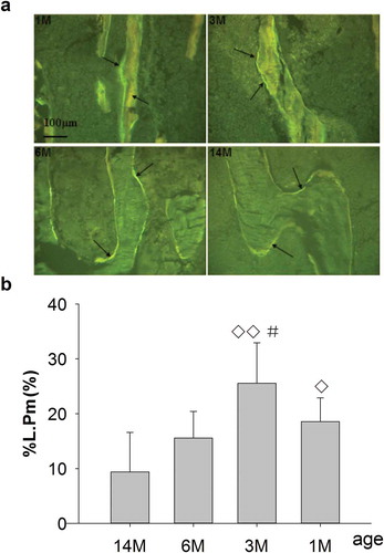 Figure 2. (a) Representative single-fluorescence micrographs of PTM in different ages rats (undecalcified sections, 8 μm, 20×). 1M: 1 month old, 3M: 3 months old, 6M: 6 months old, 14M: 14 months old. The clear and abundant single fluorescence could be seen in 1- and 3-month-old rats. There was less single fluorescence for 6-month-old rats and the minimum for 14-month-old rats, compared with 1- and 3-month-old rats. Arrows point to single fluorescence after fluorochrome labeling with tetracycline hydrochloride and calcein. Quantitative measurements of single fluorescence are shown in Figure 2b. (b) Changes of %L.Pm in rats of different ages. Data are expressed as means ± SD (n = 6) in each group. There were no significant differences in %L.Pm for 1-month-old rats vs. 6-month-old rats; however, this was significantly increased vs. 14-month-old rats, and significantly increased for 3-month-old vs. 6- and 14-month-old rats, respectively. Furthermore, there were no differences in %L.Pm for 6-month-old rats vs. 14-month-old rats. Vs. 14-month-old, ◊P < 0.05, ◊◊P < 0.01; vs. 6-month-old, #P < 0.05, Student’s t-test. PTM, the proximal tibial metaphyses; %L.Pm, percent labeled peri meter; 1M: 1-month-old, 3M: 3-month-old, 6M: 6-month-old, 14M: 14-month-old.