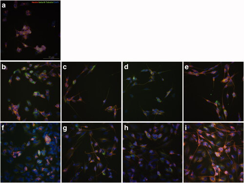 Figure 2. Expression of neural differentiation markers Nestin and β-III Tubulin changed during RAs-induced differentiation of SH-SY5Y cells. (a) SH-SY5Y cells were cultured in culture medium with no treatment as control group. (b) SH-SY5Y cells were treated with equal volume DMSO for 3 days as control. (c–e) SH-SY5Y cells treated with 9-cis-RA, 13-cis-RA and at-RA, respectively for 3 days showed increase trend in the protein level of β-III Tubulin and a decline trend of Nestin. (f) SH-SY5Y cells were treated with equal volume DMSO for 7 days as control. (g–i) SH-SY5Y cells treated with 9-cis-RA, 13-cis-RA and at-RA, respectively for 7 days showed a significant increase in β-III Tubulin and almost none Nestin. The exposure time of β-III Tubulin, Nestin and DAPI were 174 ms, 1.1 s and 31 ms, respectively.