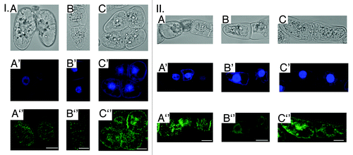 Figure 2. Alterations of general ВУ-2 cells morphology, nuclei shape and interphase MTs organization in 3 h after the UV-B exposure (A - 34 kJ/m2; B - 81 kJ/m2;C -135 kJ/m2): I. A-C - cytoplasm shrinkage; A'-C'- chromatin condensation, DAPI (4',6-diamidino-2-phenylindole) nuclei staining; A”-C” - МТs randomization/depolymerization. II. A-C - cytoplasm vacuolization; A'-C'- micronuclei formation, DAPI staining; A”-C” - МТs randomization/depolymerization. Bar - 50 μm.