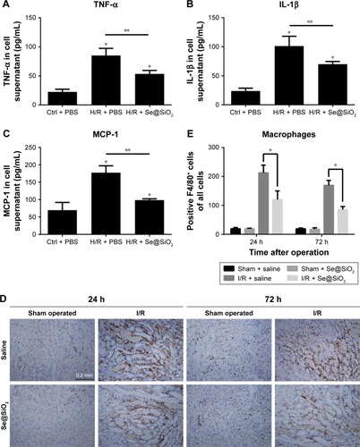 Figure 6 Changes of inflammation involving cytokines and macrophages after porous Se@SiO2 nanospheres treatment.Notes: (A–C) The secretion levels of TNF-α, IL-1β, and MCP-1 in HK-2 cells supernatant as determined by Western blotting. *P<0.05 vs Ctrl + PBS group, **P<0.05, H/R + Se@SiO2 group vs H/R + PBS group. Data were expressed as means ± SDs (n=3). (D, E) Macrophage infiltration level in mouse kidney tissues was determined by immunohistochemistry for F4/80. *P<0.05, I/R + Se@SiO2 group vs I/R + saline group. Scale bars =0.2 mm. Data were expressed as means ± SDs (n=10).Abbreviations: TNF-α, tumor necrosis factor-α; IL-1β, interleukin-1β; MCP-1, monocyte chemotactic protein-1; Ctrl, control; I/R, ischemia/reperfusion; H/R, hypoxia/reoxygenation.