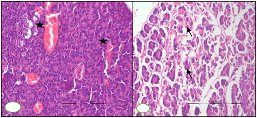 Figure 6. BTV-1, 6 ml (5.5 log10 TCID50/ml) inoculated by I/D and IV routes in sheep at 60th gestation day. H&E section, pancreases sections: (A) at 15th DPI, engorged capillaries (asterisk) in the parenchyma, ×200 and (B) at 30th DPI, disorganized atrophic pancreatic lobules characterized degenerated exocrine acini (arrow) having pycnotic nuclei and darkly stained cytoplasm, ×200.