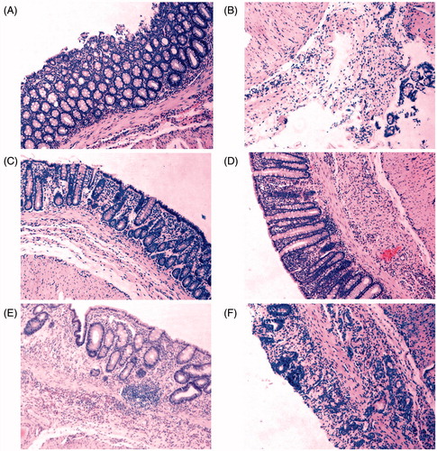 Figure 4. Representative H&E staining photomicrographs on rats rectum sections. (A) The vehicle group shows intact crypts structure and epithelial cell layer, normal goblet cells morphology. (B) The model group shows lamina propria damage, epithelial cells loss and intense inflammatory cells infiltration. (C) The sulphasalazine (SASP) (250 mg/kg) group shows regenerated mucosa and crypts and decreased inflammatory reaction. (D) The P. americana extract (PAE) (80 mg/kg) group shows no remarkable inflammatory features with normal crypts structure. (E) The PAE (40 mg/kg) group shows crypts dilation and distortion, fibrosis in lamina propria. (F) The PAE (20 mg/kg) group shows disappearance of crypts, superficial mucosal ulcer and inflammatory cells infiltration in the lamina propria. Magnification was 100×.