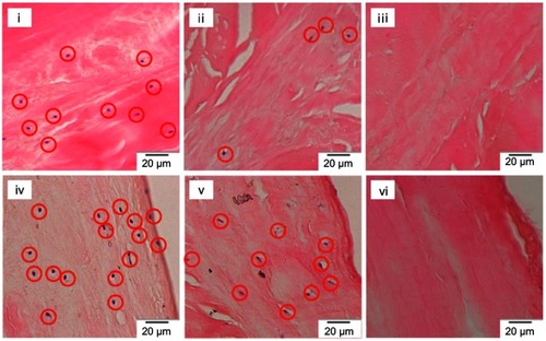 Figure 4 H&E staining of native tissues (i, iv), immersed scaffolds (ii, v) and sonicated scaffolds (iii, vi) from central and surface parts, respectively, with a magnification of 40×. The red circles represent the stained nuclei.