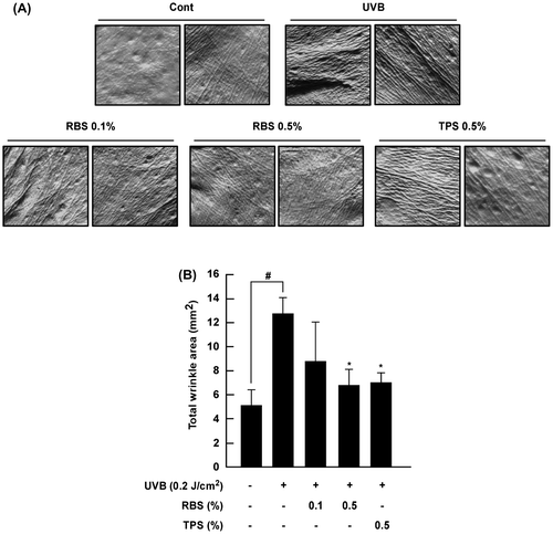 Figure 3. Effect of RBS on UVB-irradiated wrinkle formation in SKH-1 hairless mouse skin. (A) External appearance of wrinkling. (B) RBS significantly inhibits UVB-irradiated wrinkle formation in SKH-1 hairless mice. The dorsal skin surface of the animals was exposed to UVB irradiation three times per week for 16 weeks. Prior to sacrifice, skin replica samples of the dorsal areas were taken. Wrinkle values were obtained using skin replica analysis. Results are shown as means ± S.D. (n = 8). The hash symbol (#) indicates a significant difference (p < 0.05) between the control group and the UVB-irradiated group. Asterisks (*) indicate a significant difference of p < 0.05 between the RBS diet group and UVB-irradiated group.