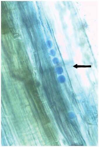 Figure 3. Spores of Piriformospora indica within root tissues of Dendrobium 30 days after inoculation.