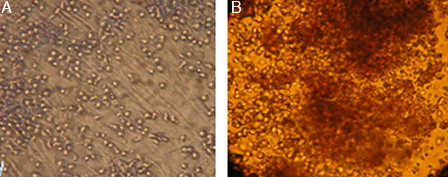 Figure 5. (A) Co-culture of HSCs with MSCs after 10 days expansion in serum-free media supplemented with cytokine cocktail. (B) CFU assay of expanded HSCs at day 10 of culture (×10).