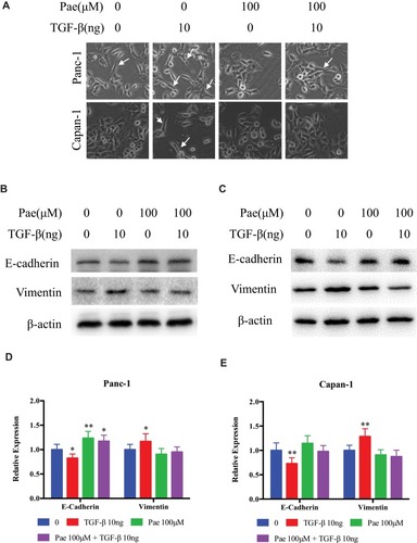 Figure 5 Paeonol attenuated mesenchymal characteristics promoting the effect of TGF-β1. (Α) Morphological changes of Panc-1 and Capan-1 cells after 48 hrs of treatment with or without Paeonol (100μΜ) and with or without TGF-β1 (10ng). Arrows indicate cell shapes representing mesenchymal phenotypes; (B, C) Western blot analysis of protein levels of E-cadherin, Vimentin in Panc-1 and Capan-1 cells treated with or without Paeonol (100μΜ) and with or without TGF-β1 (10ng) for 48 hrs; (D, E) Histograms show the change of relative protein expression of E-cadherin, Vimentin in Panc-1 and Capan-1 cells. Data are shown as mean ± SD of three independent experiments. *P < 0.05, **P < 0.01.