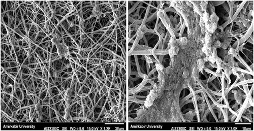 Figure 2. SEM Image of CJMSCs differentiated to ILCs on PCL nanoflbrous scaffolds.