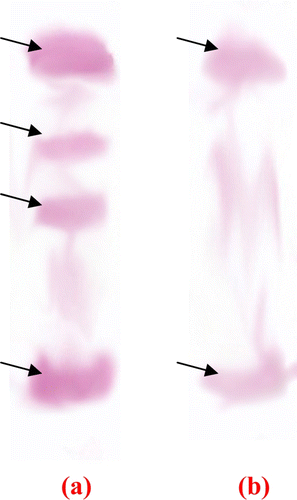 Figure 2.  Isoforms of proteases from crude HGP.