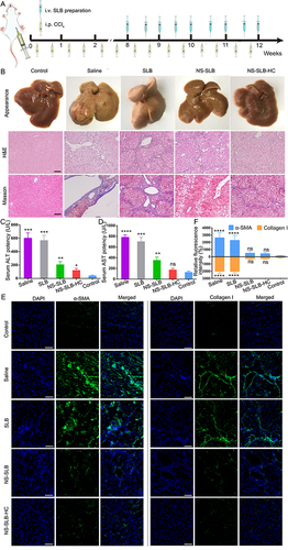 Figure 4 Efficacy of nanosuspensions against CCl4-induced hepatic fibrosis in mice. (A) Schematic of treatment schedule. (B) Appearance and histological analysis of liver tissues after 12 weeks of treatment with different formulations. Scale bar, 100 μm. (C and D) Levels of (C) alanine aminotransferase (ALT) and (D) aspartate aminotransferase (AST) after 12 weeks of treatment. Normal mice were used as controls. (E) Immunofluorescence staining of liver sections against α-smooth muscle actin (α-SMA) or collagen I with Alexa Fluor® 488-labeled IgG (green) after 12 weeks of treatment. Cell nuclei were stained with DAPI (blue). Scale bar, 50 μm. (F) Semi-quantitative analysis of immunofluorescence images. Data are shown as mean ± SD (n = 5). ****P < 0.0001; ***P < 0.001; **P < 0.01; *P < 0.05; ns, non-significant difference vs control.