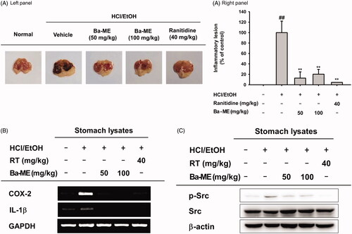 Figure 4. Anti-inflammatory effect of Ba-ME on HCl/EtOH-induced gastritis in mice. (A) Mice were orally injected with Ba-ME (50 and 100 mg/kg) or ranitidine (40 mg/kg) four times before oral administration of HCl/EtOH. At 1 h after administration of HCl/EtOH, the stomachs of the mice were excised, and gastric lesions in the stomachs were measured with ImageJ. The gastritis index of the control group (inducer alone) is represented as 100%. (B) mRNA expression levels of COX-2 and IL-1β in the stomach tissues of mice treated with HCl/EtOH were determined by semiquantitative RT-PCR. (C) Levels of the total and phosphorylated forms of Src in stomach tissues of mice treated with HCl/EtOH were examined by western blotting. ##p < 0.01 compared with the normal group and **p < 0.01 compared with the control group.
