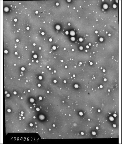 FIG. 2 Electronic transmission microscopy shows PELGE nanoparticles (× 200,000).