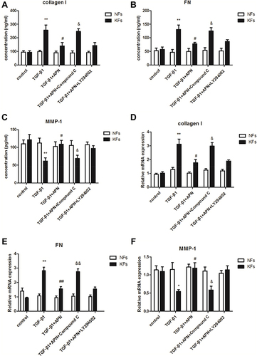 Figure 4 Adiponectin attenuated TGF-β1 mediated expression of collagen I and FN, and upregulates TGF-β1 suppressed MMP-1 expression in KFs by AMPK signaling pathway. KFs and NFs were preincubated with Compound C (10 µM, an AMPK inhibitor), or LY294002 (10 µM, a PI3K inhibitor) or without inhibitors for 24 h. After stimulation with or without adiponectin (APN, 5 µg/mL) in the presence of TGF-β1 (10 ng/mL) for 24 h, the supernatant concentration and mRNA levels of type I collagen (A and D), FN (B and E), and MMP-1 (C and F) in KFs and NFs were examined by ELISA and qPCR, respectively. Data represent at least three independent experiments. *P<0.05 versus the control group, **P<0.01 versus the control group; #P<0.05 versus the TGF-β1 group, ##P<0.01 versus the TGF-β1 group; &P<0.05 versus the TGF-β1+adiponectin group, &&P<0.01 versus the TGF-β1+adiponectin group. The results are shown as means±SE.