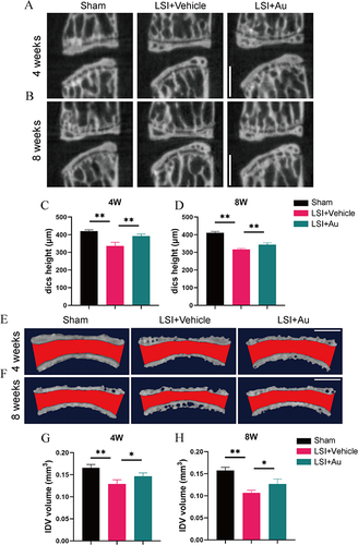 Figure 2 Au mitigated IDD in LSI mice. (A and B) Representative micro-CT images of midsagittal plane at L4-L5. Scale bar = 500 μm. (C and D) Quantitative analysis of disc height at L4-5. (E and F) Representative 3D-reconstruction images of L4–5 endplate with coronal plane. Red area indicated IVD space. Scale bar = 500 μm. (G and H) Quantitative analysis of the IVD volume of ROI. The dose of Au was 10 mg/kg/day. Data were presented as means ± S.D. *p < 0.05, **p < 0.01; n ≥ 4 in each group.