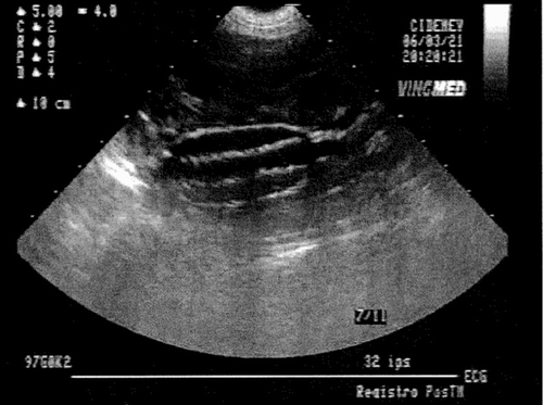 Figure 12 Echodoppler before the sacrifice of a whose stent-graft was implanted for 6 months.