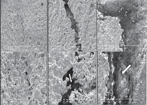 Figure 4 Scanning electron micrographs of cotyledon cells of red lentil seeds at a moisture content of 16.8% (w.b.): (a, d) without compression; (b, e) compression loading under horizontal orientation; (c, f) compression loading under vertical orientation. Bar = 200 μm in (a–c) and 100 μm in (d–f).