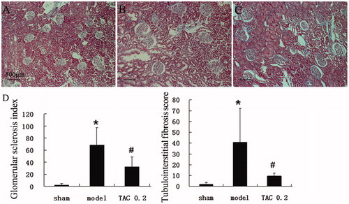 Figure 1. TAC delayed glomerular sclerosis and tubular fibrosis in 5/6 nephrectomized rats. Then, renal sections were detected by light microscopy after Masson staining (original magnification: ×100). (A) Normal renal cortex. (B) In 5/6 nephrectomized rats, glomeruli showed obviously mesangial expansion and glomerular sclerosis, as well as interstitial fibrosis and tubular atrophy. (C) In TAC treated rats, the range of glomerular sclerosis and interstitial fibrosis was significantly less than the model group, tubular atrophy was also alleviated. (D) Glomerular sclerosis index and tubulointerstitial fibrosis score were significantly increased in the model group, which were obviously decreased by TAC. *p < 0.05 versus sham-operated rats, #p < 0.05 versus 5/6 nephrectomized rats.