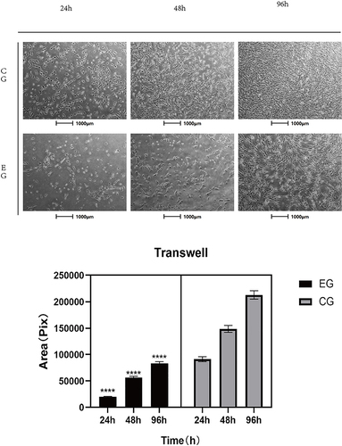 Figure 4 Results of the Transwell experiment. Control group: The growth of cells in the control group after 24, 48, and 96 h. Experimental group: The growth of cells in the experimental group after 24, 48, and 96 h. Area: The plot of cell picture measurement data.