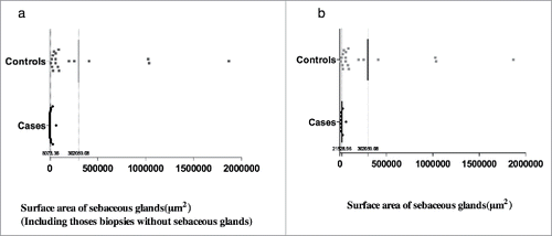Figure 3. (a) Comparison of surface area of sebaceous glands between patients and controls, the mean surface area of sebaceous glands (below the dotted line) in patients is smaller than controls (8073.36 ± 15798.43 μmCitation2 versus 302059.08 ± 502813.78 μmCitation2, P = 0.024). (b) Surface area of sebaceous glands where the biopsies with no visible sebaceous glands have been omitted, the mean surface area of sebaceous glands (below the dotted line) in patients is lower than controls (21528.97 ± 19790.81 μmCitation2 versus 302059.08 ± 502813.78 μmCitation2, P = 0.03).