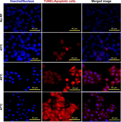 Figure 11 Hoechst/TUNEL staining of B16F1 cells 24 hours after a single cycle of RF-induced dextran-coated LSMO-mediated hyperthermia as compared with no RF control.Abbreviations: LSMO, La0.7Sr0.3MnO3; RF, radiofrequency; TUNEL, terminal deoxynucleotidyl transferase-dUTP nick end labeling.