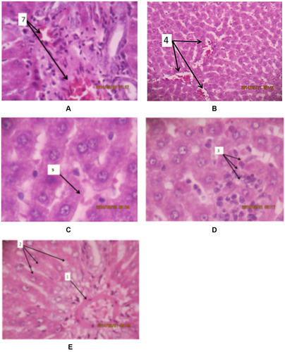 Figure 1 Sections of liver tissue from different groups. (A) Control, (B) saline, (C) garlic, (D) exercised, and (E) exercise + garlic groups: (1) central vein, (2) hepatocells; (3)and (7) mild parenchymal inflammation; (4) and (5) sinusoidal dilatation.
