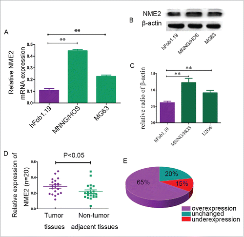 Figure 1. Compared to the control group, NME2 expression was high in OS cell lines and clinical OS tumor tissues. (A) RT-PCR confirmed that the mRNA expression of NME2 was significantly higher in MNNG/HOS and MG63 cell lines than in hFob1.19 cell lines. (B) NME2 protein was overexpressed in MNNG/HOS and MG63 cell lines compared to hFob1.19. (C) The mRNA expression levels of NME2 in clinical tumor tissues were significantly higher than in the corresponding adjacent non-tumor tissues. (D) RT-PCR demonstrated that the NME2 expression in tumor tissues was 65% higher than in non-tumor tissues.