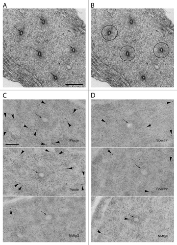 Figure 7. Immunoelectron microscopy of sections labeled for plectin and spectrin. (A) In conventional electron micrographs, the actin network surrounding the central plasma membrane elements (arrows) of tubulobulbar complexes is clearly evident as a dense cuff. (B) This image is the same as in (A), but with the actin rich cuffs circled by the black lines in three of the five complexes. (C) The upper two images are of tubulobulbar complexes labeled for plectin, and the lower image is of the specificity control labeled with normal mouse IgG (NMIgG). The arrows indicate the central membrane elements of each complex. Notice that the gold particles are excluded from the actin cores in material labeled for plectin. (D) The upper two images are of tubulobulbar complexes labeled for spectrin, and the lower image is of the specificity control labeled with normal mouse IgG (NMIgG). The arrows indicate the central membrane elements of each complex. Gold particles are generally excluded from the actin cores. (A and B) Bar = 500 nm. (C and D) Bar = 200 nm.