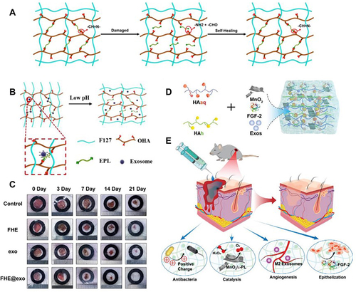 Figure 4 (A) Schematic diagram of the self-healing process of hydrogels. (B) pH-dependent release of exosomes from hydrogels. (C) The healing process of wounds treated with hydrogel, exosomes, exosome-loaded hydrogel and control wounds. Adapted with permission from Wang C, Wang M, Xu T, et al. Engineering Bioactive self-healing antibacterial exosomes hydrogel for promoting chronic diabetic wound healing and complete skin regeneration. Theranostics. 2019;9:65–76, Open Access.Citation133 (D) Hydrogel consisting of Cothe HA@MnO2/FGF-2/Exos is formed by the Schiff base reaction of hydrazides and aldehydes. (E) HA@MnO2/FGF-2/Exos hydrogel can be quickly formed by simple mixing injections, in which grafted ortho-quaternary ammonium groups have long-term antibacterial efficacy. The MnO2/ε-PL nanosheet is a nanoenzyme that catalyzes the oxidation of H2O2 into O2. The release of ExosM2@miR−223 mimicked persistent angiogenesis, and the release of FGF-2 enhanced epithelial formation. Reprinted with permission from Xiong Y, Chen L, Liu P, et al. All-in-One: multifunctional Hydrogel Accelerates Oxidative Diabetic Wound Healing through Timed-Release of Exosome and Fibroblast Growth Factor. Small. 2022;18:e2104229.© 2021 The Authors. Small published by Wiley-VCH GmbH.Citation142