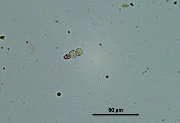 Figure 3. 20X capture of protoplasts obtained from mycelia by incubation with lytic enzyme for 6 hours. Bar indicates 50 µm length.