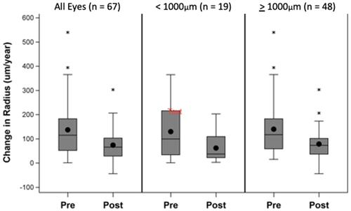 Figure 5 Boxplots showing the distribution of change in radius, pre and post treatment. Plots are stratified by samples of all eyes (n=67), eyes with initial diameter <1000µm (n=19) and eyes with initial diameter >1000µm (n=48). Boxplots display the mean (black dot), median (line within the box), interquartile range (IQR) including the 25th percentile (bottom of the box) and 75th percentile (top of the box), observations within 1.5 times the IQR (upper and lower fences), and outliers (asterisks, observations outside 1.5 times the IQR). For each comparison panmacular SDM laser significantly reduced the annual rate of linear radial progression of geographic atrophy (p<0.0001, linear regression analysis). A linear mixed model accounting for inter-eye correlation was performed to test the potential difference between eyes with smaller (≤ 1000um) vs larger (>1000um) initial lesion diameters. Initial lesion size did not significantly affect rates of progression either before after SDM treatment (pre-treatment continuous measure (p = 0.919), dichotomized scale (p = 0.824); post treatment continuous measure (p = 0.408), dichotomized scale (p = 0.269).