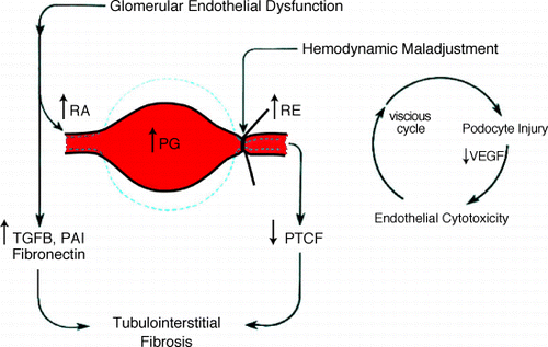 Figure 2. Hemodynamic maladjustment in NS‐FSGS. (View this art in color atwww.dekker.com.)