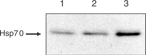 Figure 2. The accumulation of Hsp70 proteins after WBH: tumor-bearing mice were treated with WBH for 30 or 60 min. Whole cancer cell extracts of subcutaneous tumor were prepared at 6 h after WBH. The accumulation of Hsp70 was assessed by Western blotting. Lane 1: untreated control, Lane 2: WBH for 30 min, Lane 3: WBH for 60 min.