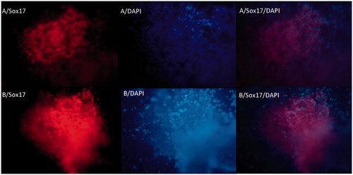 Figure 5. The immunochemical analysis of differentiated iPSc after 5 days for Sox17 markers on random (A) and aligned (B) nanofibers with nuclear counterstaining (DAPI).