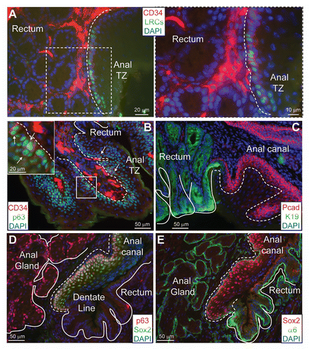 Figure 5 Expression of stem cell markers at the anorectal junction. (A) CD34 is expressed at a low level in the H2B-GFP retaining cells (LRCs). High expression of CD34 is detected in the stroma surrounding the anal region. Boxed area is magnified and shown to the right, demonstrating CD34 expression in the GFP-retaining cells. (B) p63 is expressed through the entire basal layer of the anal epithelium and the anal glands, colocalizing with CD34 in a small group of cells at the anorectal transitional zone (indicated with white arrows). Boxed area enlarged in inset, showing the expression of CD34. (C) Keratin 19 is expressed in the simple epithelium of the rectum and not in the anal transitional cells. (D and E) Sox2 is expressed in the basal cells of the anal epithelium (including the anal transition zone) and its expression decreases as cells differentiate. Sox2 and p63 are not expressed in the rectum. K19, Keratin 19; LRCs, H2B-GFP-retaining cells; α6, α6-integrin.