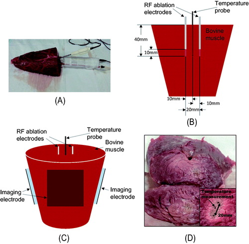 Figure 2. Experimental set-up to monitor RF ablation of ex vivo bovine muscle tissue using MREIT. (A) Chunk of bovine muscle tissue with a pair of RF ablation electrodes and a temperature probe for direct temperature measurements. (B) Non-magnetic silver needle (14 gauge) electrodes for RF ablation. (C) Diagram of the electrode and sensor configurations. (D) Cross-section of the bovine muscle tissue after RF ablation with a magnified view of the lesion (inset).