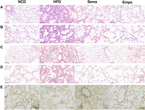 Figure 4 Images using H&E staining on lung tissues from four distinct groups, featuring scale bars measuring 100 µm (A) and 50 µm (B). Images of lung tissues from four distinct groups, stained with Masson’s trichrome, featuring scale bars at 100 µm (C) and 50 µm (D). Representative EVG staining images of lung tissue of 4 different groups with scale bars at 100 µm (E).
