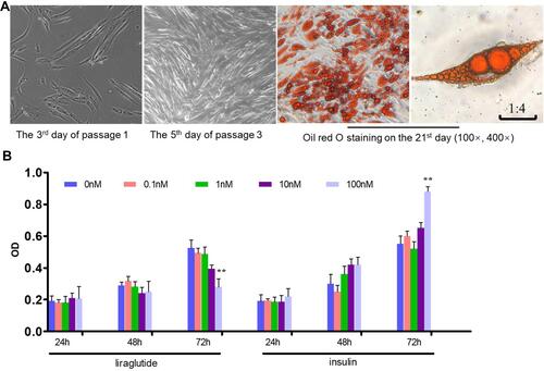 Figure 1 Primary culture of human adipose-derived stem cells (hADSCs) and the effects of liraglutide and insulin on hADSCs proliferation. (A) Culture of hADSCs and oil red O staining. (B) MTT assay (**p<0.01).