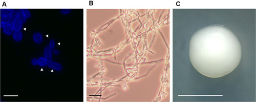 Figure 1 Candida krusei cell and colony morphology. (A) Yeast cells were grown in YPD broth until reach the exponential phase and then stained with calcofluor white, to label chitin. Scale bar = 10 µm. The arrowheads indicate the mother cells. (B) Cell filamentation was stimulated in RPMI medium incubated at 37°C. Scale bar = 20 µm. (C) A C. krusei colony grown on a YPD plate. Scale bar = 5.0 mm. Images from panels A and B were taken with a Zeiss Axioscope-40 microscope and an Axiocam MRc camera.