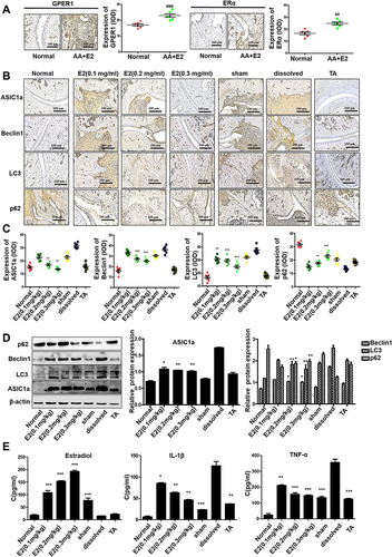 Figure 2 Estradiol-mediated protection against the autophagy of articular cartilage in OVX rats with AA in vivo. (A) The immunohistochemistry results of GPER1 and ERα of the Normal group and the AA+E2 group. Semiquantitative analysis of GPER1 and ERα expression in ankle joint of each group (n = 7) were calculated using the IPP 6.0 software. (B) Immunohistochemistry analysis of Beclin1, LC3, p62 and ASIC1a in articular cartilage tissue of all groups (n = 7). (C) Semi-quantitative analysis of ASIC1a, Beclin1, LC3, p62 expression in rat cartilage by integral optical density (IOD). (D) The protein expression levels of Beclin1, LC3, ASIC1a and p62 in articular cartilage tissue of all groups were measured by Western blot. β-actin served as a loading normal, and the indicated proteins were quantified with Image J software. (E) Estradiol, IL-1β and TNF-α levels in the serum of all groups were measured by ELISA assay (n = 7). Data are presented as the mean ± SEM of three independent experiments. (A) ##P < 0.01, ###P < 0.001 compared with the Normal group. (C–E) *P < 0.05, **P < 0.01, ***P < 0.001 compared with the solvent-treated group.