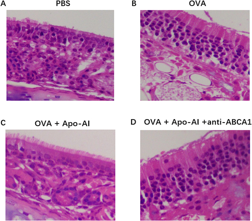 Figure 4 Morphology of nasal turbinate of mice model. (A) PBS group. (B) OVA-challenged AR mice. (C) Apo- AI treated AR mice. (D)Apo-AI and anti-ABCA1 treated mice.